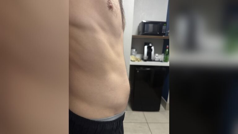 Why am I Underweight But Still Fat: Shocking Truths Revealed